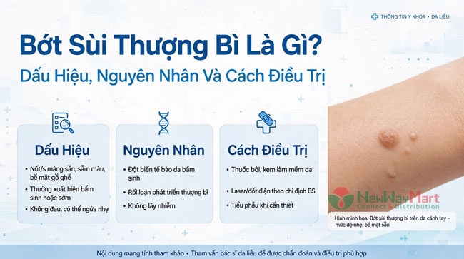 Bớt Sùi Thượng Bì Là Gì? Dấu Hiệu, Nguyên Nhân Và Cách Điều Trị