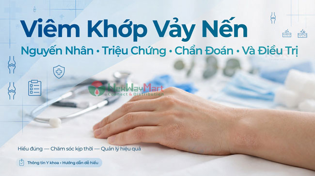 Viêm Khớp Vảy Nến: Nguyên Nhân, Triệu Chứng, Chẩn Đoán Và Điều Trị
