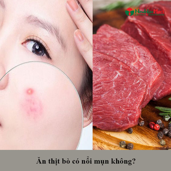 Ăn Thịt Bò Có Nổi Mụn Không? Bị Mụn Ăn Thịt Bò Được Không?