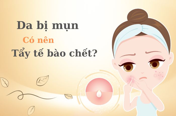 [Giải đáp] Da mụn có nên tẩy tế bào chết không? Chăm sóc da mụn sau khi tẩy tế bào chết