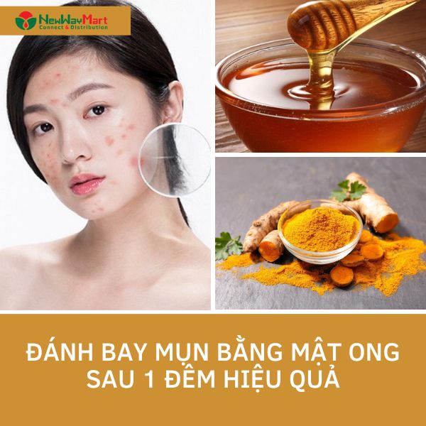 Đánh bay mụn bằng mật ong sau 1 đêm hiệu quả nhất