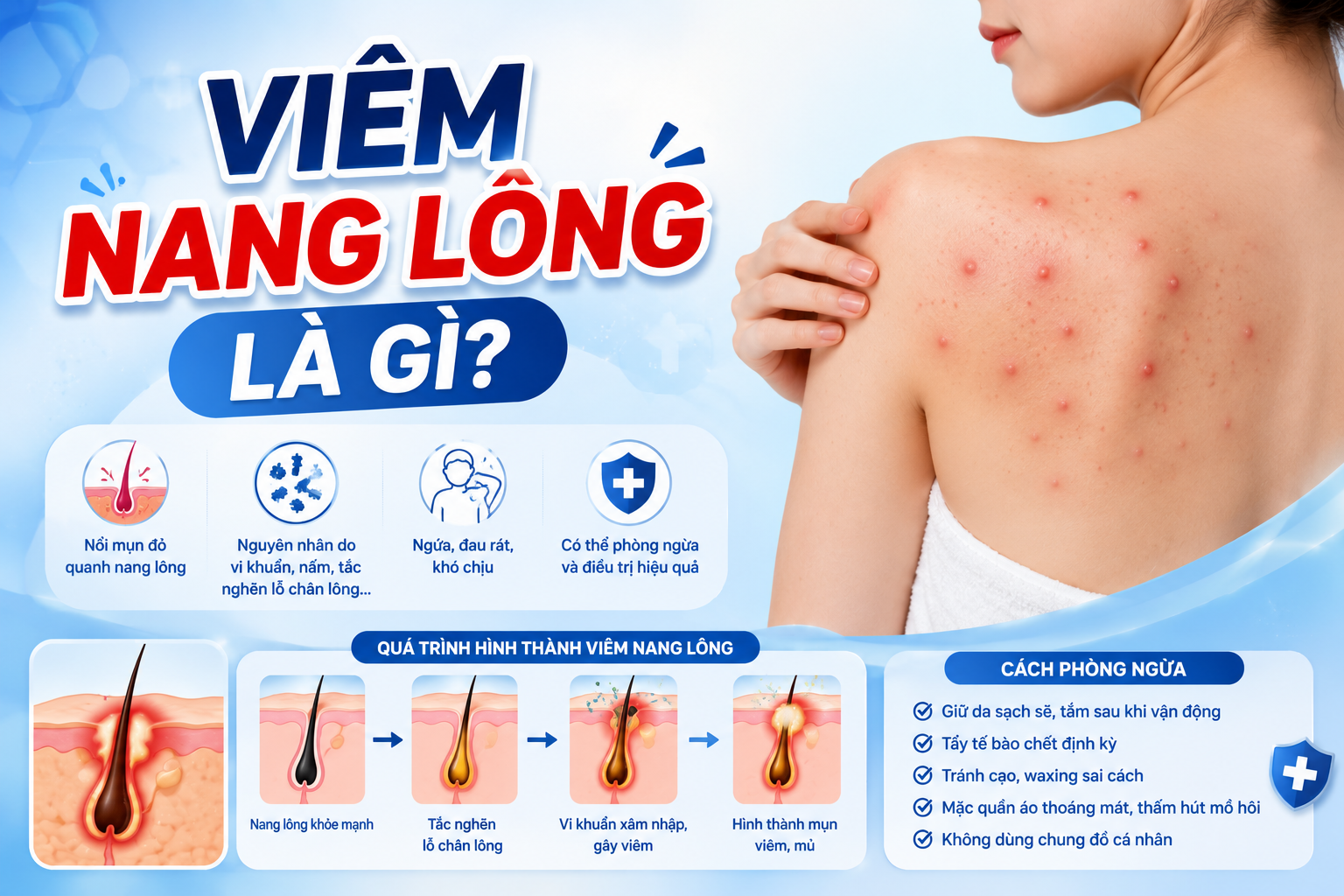 Viêm Nang Lông Là Gì? Nguyên Nhân, Dấu Hiệu Và Cách Cải Thiện