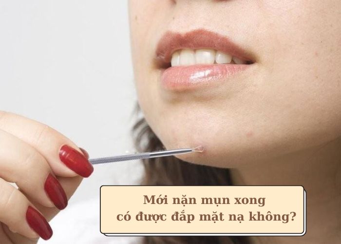 Mới nặn mụn xong có nên đắp mặt nạ không? Nên đắp mặt nạ gì?