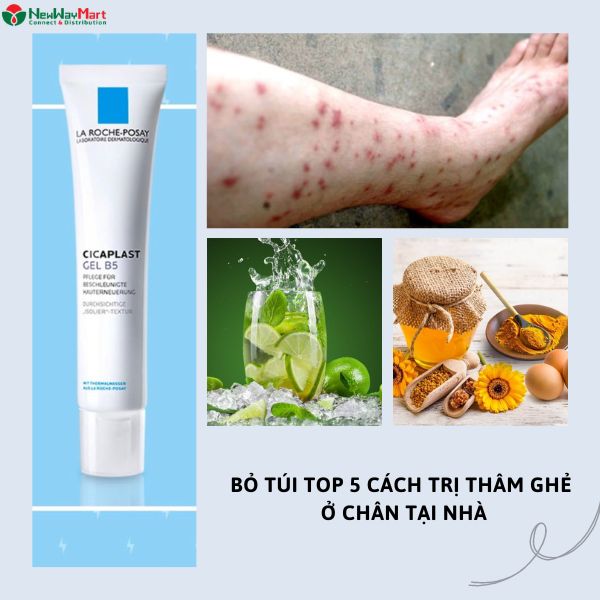 Bỏ túi ngay top 5 cách trị thâm ghẻ ở chân tại nhà hiệu quá