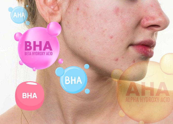 TOP 05 Serum BHA trị mụn: Làm sạch lỗ chân lông, giảm sưng viêm