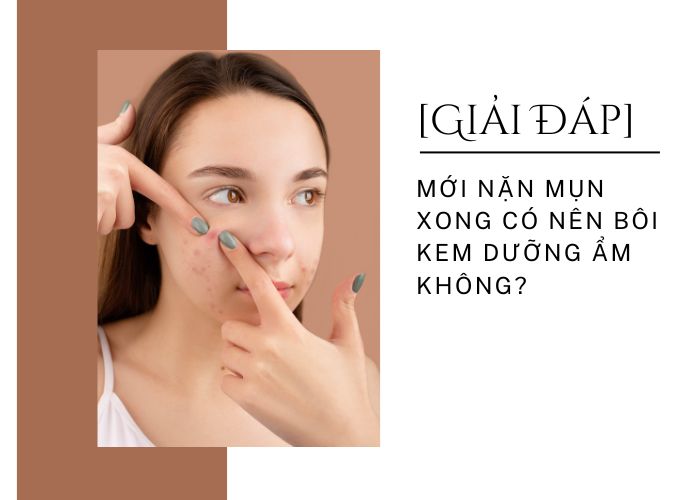 [Giải đáp] Mới nặn mụn xong có nên bôi kem dưỡng ẩm không?