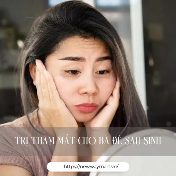 Bí kíp trị thâm mắt cho bà đẻ sau sinh hiệu quả. Đọc ngay!